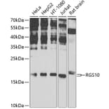 Western Blot - Anti-RGS10 Antibody (A16947) - Antibodies.com