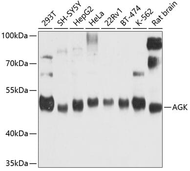 Western blot analysis of extracts of various cell lines, using Anti-AGK Antibody (A9976) at 1:1,000 dilution. Secondary antibody: Goat Anti-Rabbit IgG (H+L) (HRP) (AS014) at 1:10,000 dilution. Lysates / proteins: 25µg per lane. Blocking buffer: 3% non-fat dry milk in TBST. Detection: ECL Enhanced Kit (RM00021). Exposure time: 60s.