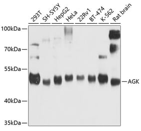 Western Blot - Anti-AGK Antibody (A16948) - Antibodies.com