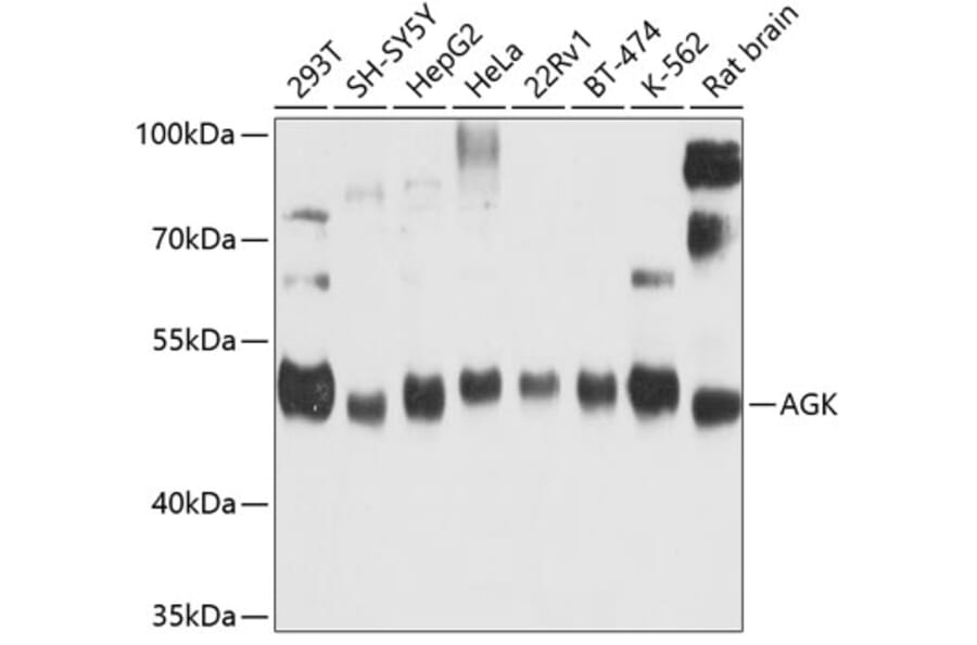 Western Blot - Anti-AGK Antibody (A16948) - Antibodies.com