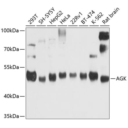 Western Blot - Anti-AGK Antibody (A16948) - Antibodies.com