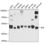 Western Blot - Anti-AGK Antibody (A16948) - Antibodies.com