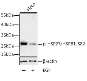 Western Blot - Anti-Hsp27 (phospho Ser82) Antibody (A16949) - Antibodies.com