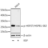 Western Blot - Anti-Hsp27 (phospho Ser82) Antibody (A16949) - Antibodies.com