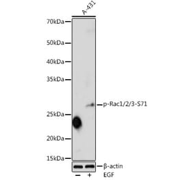 Western Blot - Anti-Rac1 (phospho Ser71) Antibody (A16950) - Antibodies.com