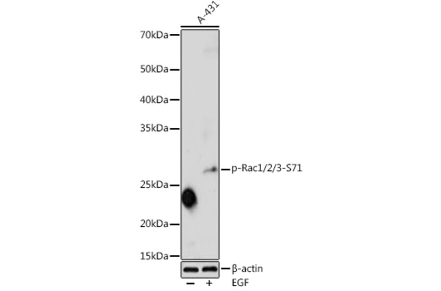 Western Blot - Anti-Rac1 (phospho Ser71) Antibody (A16950) - Antibodies.com