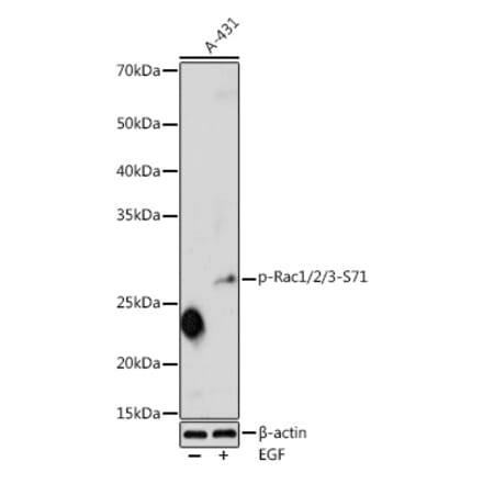 Western Blot - Anti-Rac1 (phospho Ser71) Antibody (A16950) - Antibodies.com