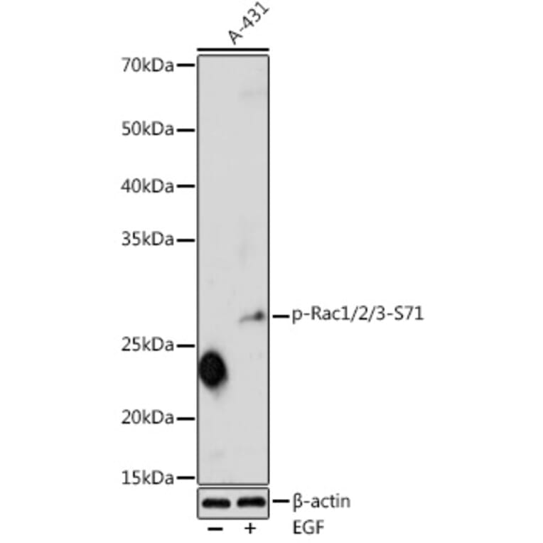 Western Blot - Anti-Rac1 (phospho Ser71) Antibody (A16950) - Antibodies.com