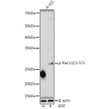 Western Blot - Anti-Rac1 (phospho Ser71) Antibody (A16950) - Antibodies.com