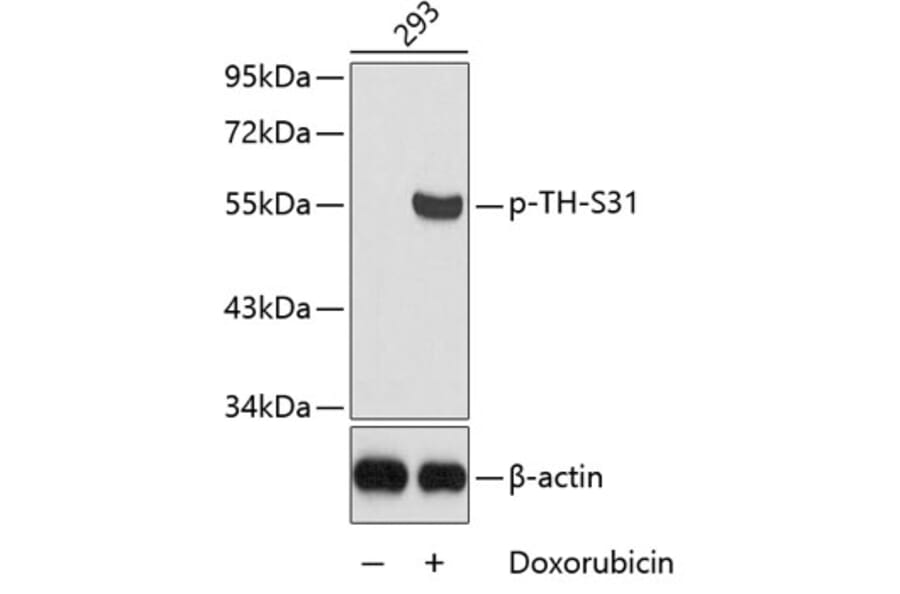Western Blot - Anti-TH (phospho S31) Antibody (AP0210) - Antibodies.com