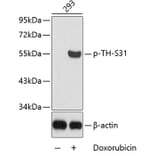 Western Blot - Anti-TH (phospho S31) Antibody (AP0210) - Antibodies.com