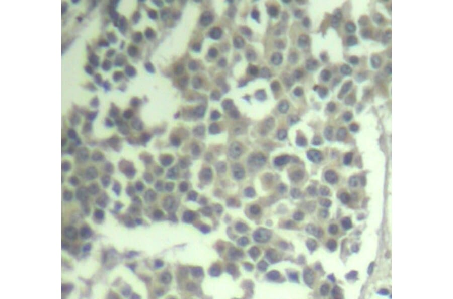 Immunohistochemistry - Anti-KIT (phospho Y936) Antibody (AP0286) - Antibodies.com