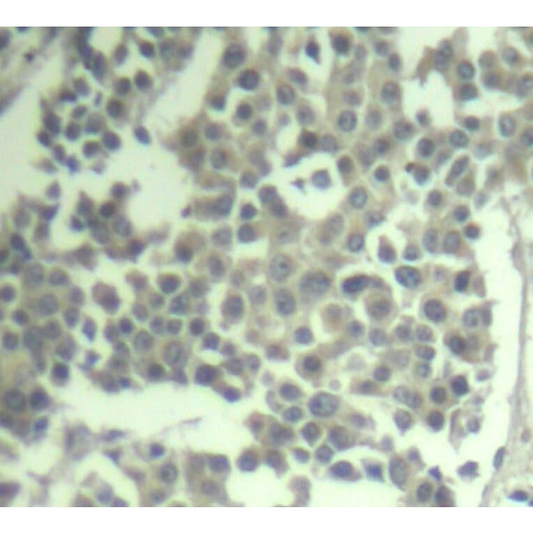 Immunohistochemistry - Anti-KIT (phospho Y936) Antibody (AP0286) - Antibodies.com