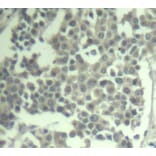 Immunohistochemistry - Anti-KIT (phospho Y936) Antibody (AP0286) - Antibodies.com
