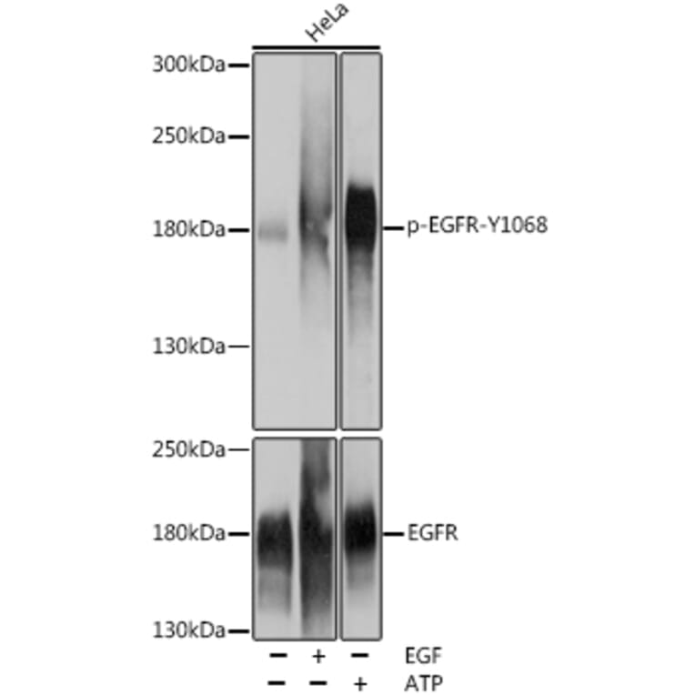 Western Blot - Anti-EGFR (phospho Tyr1068) Antibody (A16953) - Antibodies.com