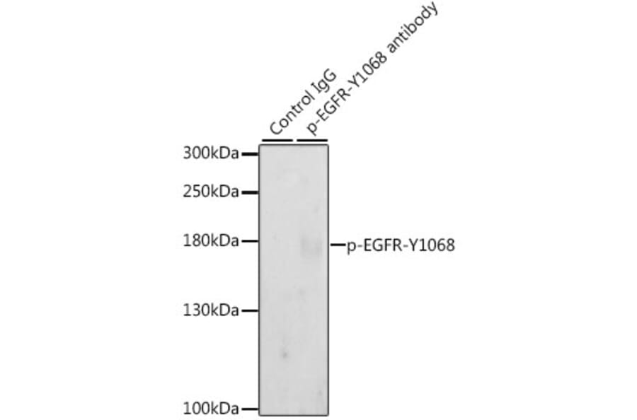 Western Blot - Anti-EGFR (phospho Tyr1068) Antibody (A16953) - Antibodies.com