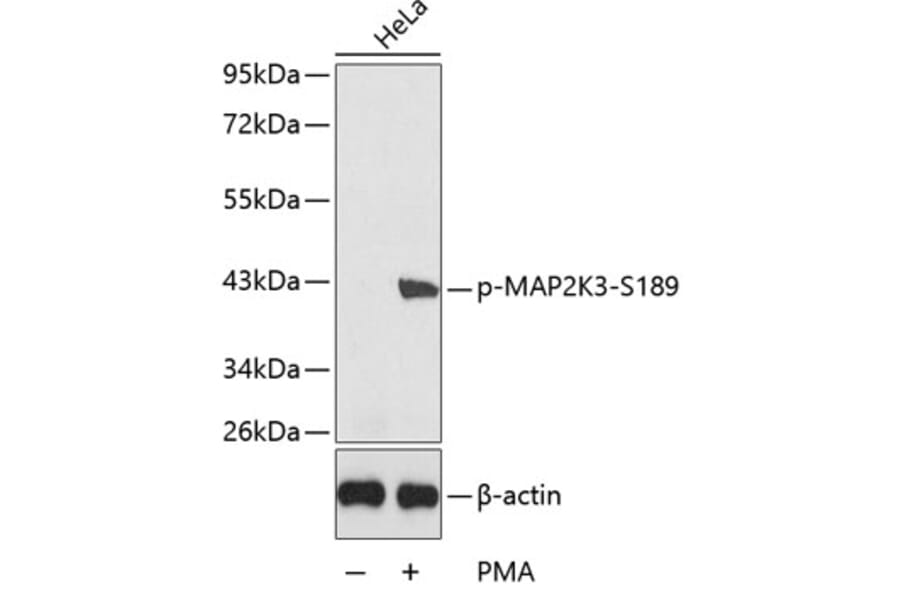 Western Blot - Anti-MAP2K3 (phospho S189) Antibody (AP0389) - Antibodies.com