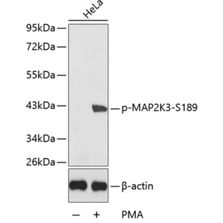 Western Blot - Anti-MAP2K3 (phospho S189) Antibody (AP0389) - Antibodies.com