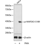 Western Blot - Anti-MAP2K3 (phospho S189) Antibody (AP0389) - Antibodies.com
