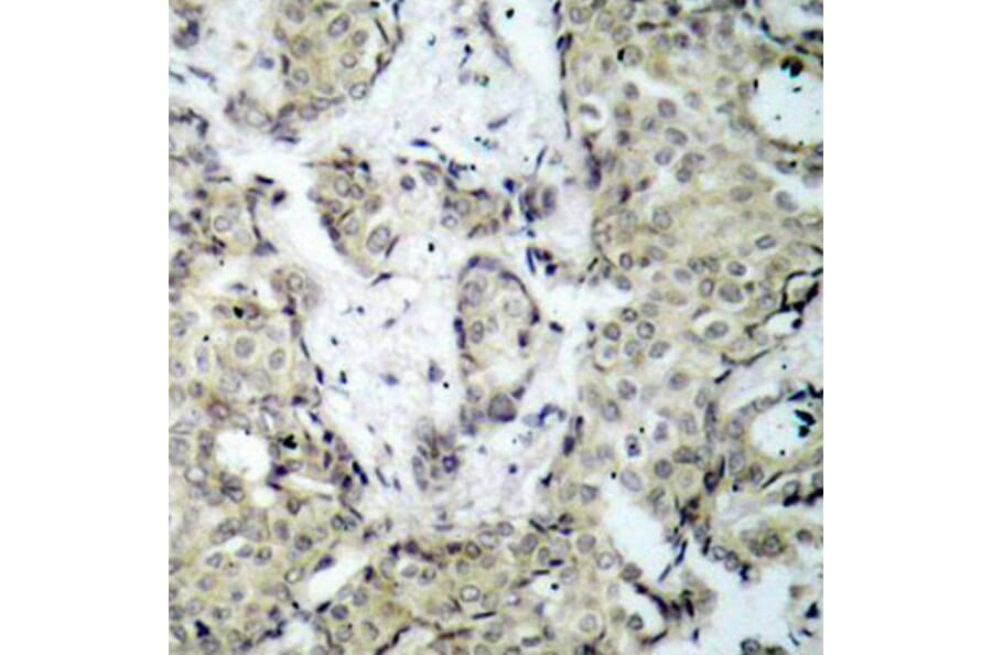 Immunohistochemistry - Anti-MAP2K3 (phospho S189) Antibody (AP0389) - Antibodies.com