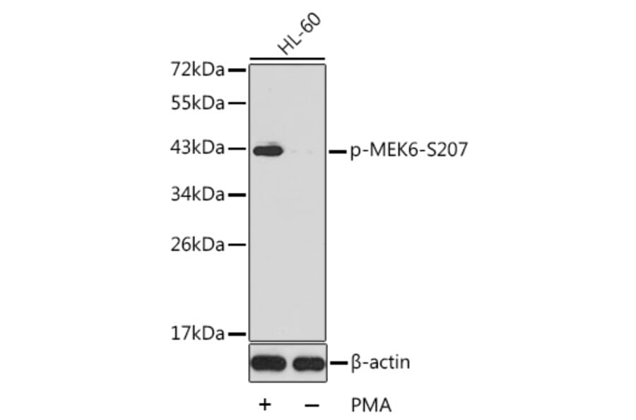 Western Blot - Anti-MKK6 (phospho Ser207) Antibody (A16955) - Antibodies.com