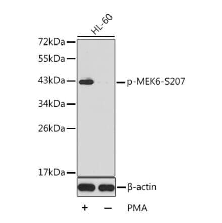 Western Blot - Anti-MKK6 (phospho Ser207) Antibody (A16955) - Antibodies.com