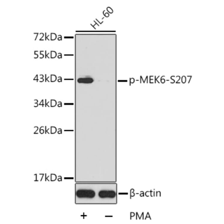 Western Blot - Anti-MKK6 (phospho Ser207) Antibody (A16955) - Antibodies.com