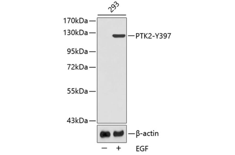 Western Blot - Anti-PTK2 (phospho Y397) Antibody (AP0437) - Antibodies.com