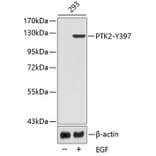 Western Blot - Anti-PTK2 (phospho Y397) Antibody (AP0437) - Antibodies.com