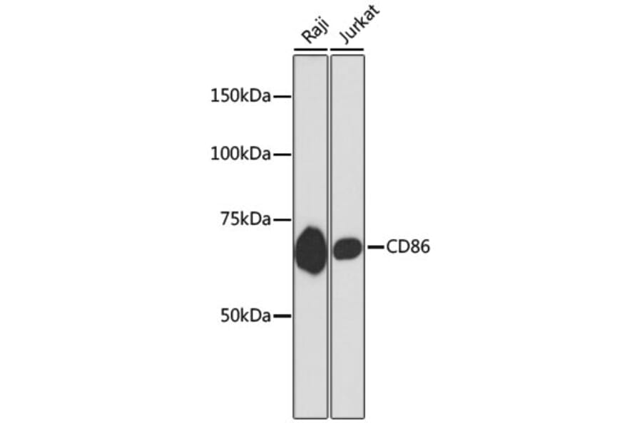 Western Blot - Anti-CD86 Antibody (A10795) - Antibodies.com