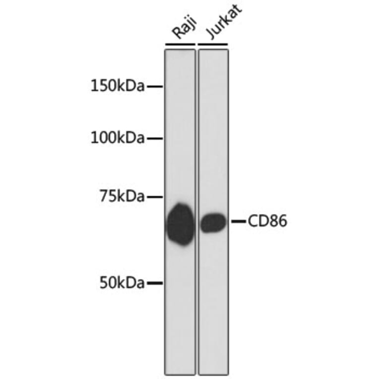 Western Blot - Anti-CD86 Antibody (A10795) - Antibodies.com