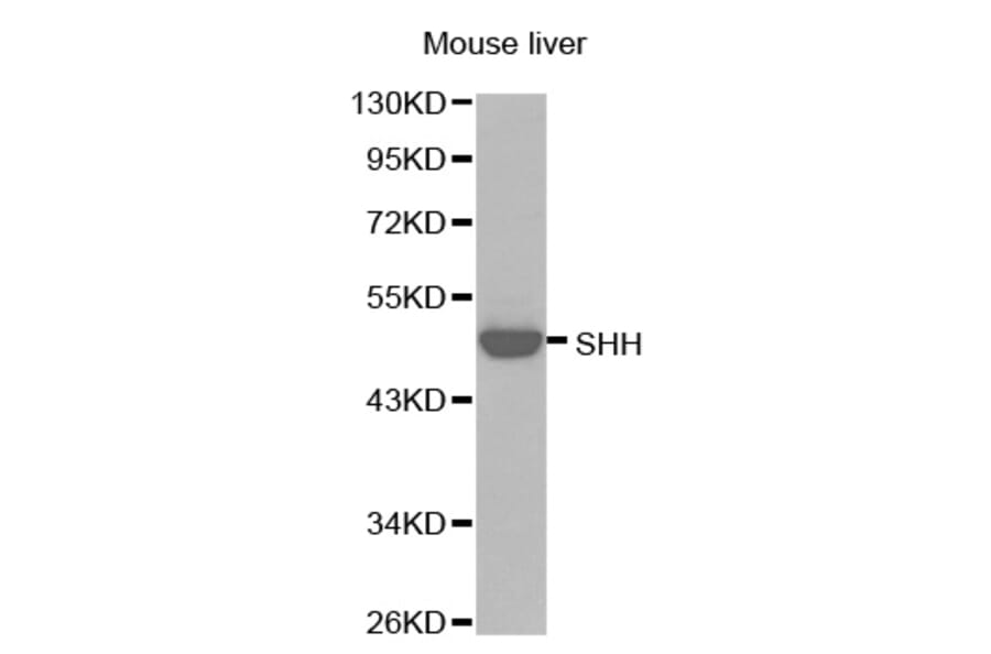 Western Blot - Anti-SHH Antibody (A0095) - Antibodies.com