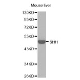 Western Blot - Anti-SHH Antibody (A0095) - Antibodies.com