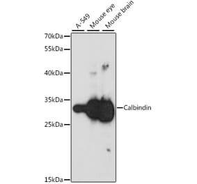 Western Blot - Anti-Calbindin Antibody (A16967) - Antibodies.com