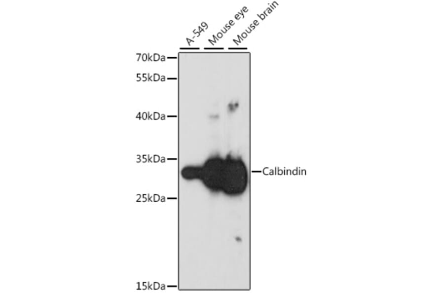Western Blot - Anti-Calbindin Antibody (A16967) - Antibodies.com