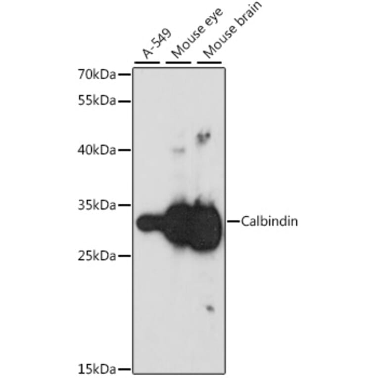 Western Blot - Anti-Calbindin Antibody (A16967) - Antibodies.com