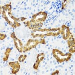 Immunohistochemistry - Anti-Calbindin Antibody (A16967) - Antibodies.com