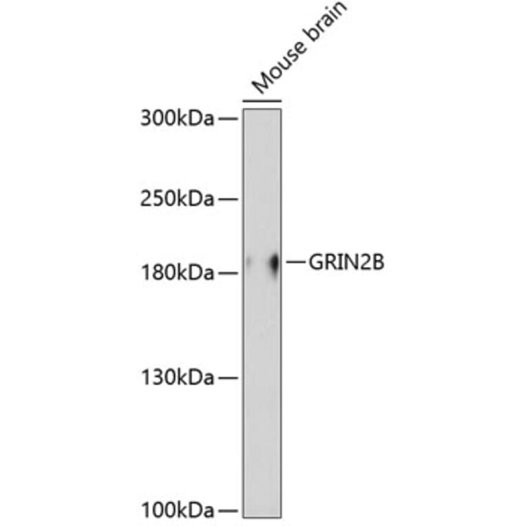 Western Blot - Anti-GRIN2B Antibody (A0890) - Antibodies.com