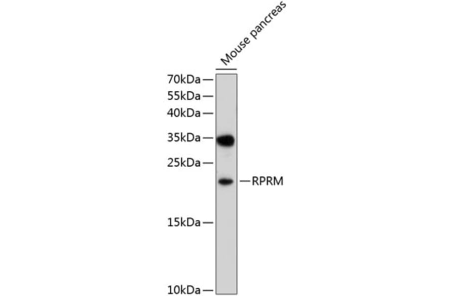 Western Blot - Anti-RPRM Antibody (A16969) - Antibodies.com