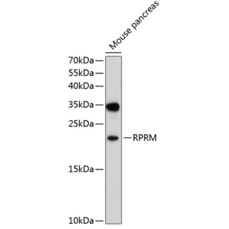Western Blot - Anti-RPRM Antibody (A16969) - Antibodies.com