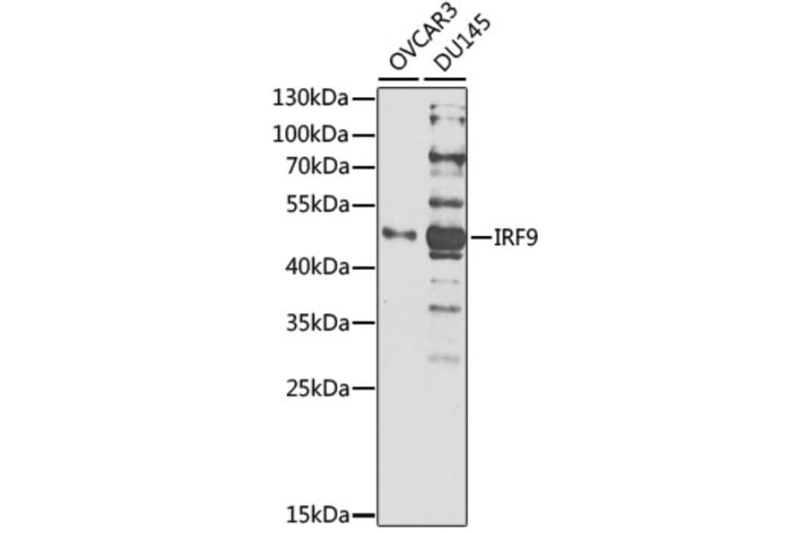 Western Blot - Anti-IRF9 Antibody (A1004) - Antibodies.com