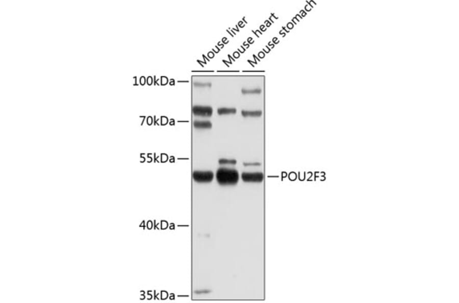 Western Blot - Anti-Skn1 Antibody (A16971) - Antibodies.com