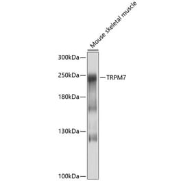 Western Blot - Anti-TRPM7 Antibody (A16973) - Antibodies.com
