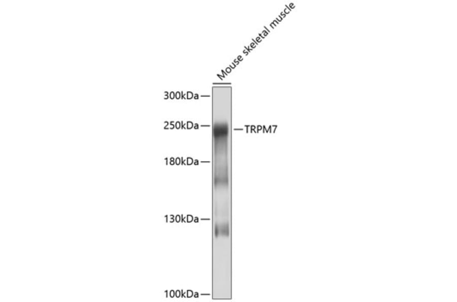 Western Blot - Anti-TRPM7 Antibody (A16973) - Antibodies.com
