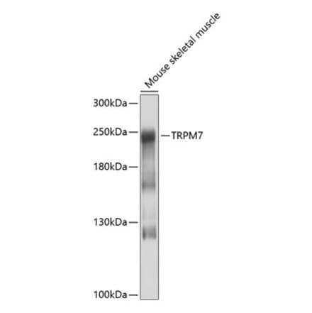 Western Blot - Anti-TRPM7 Antibody (A16973) - Antibodies.com