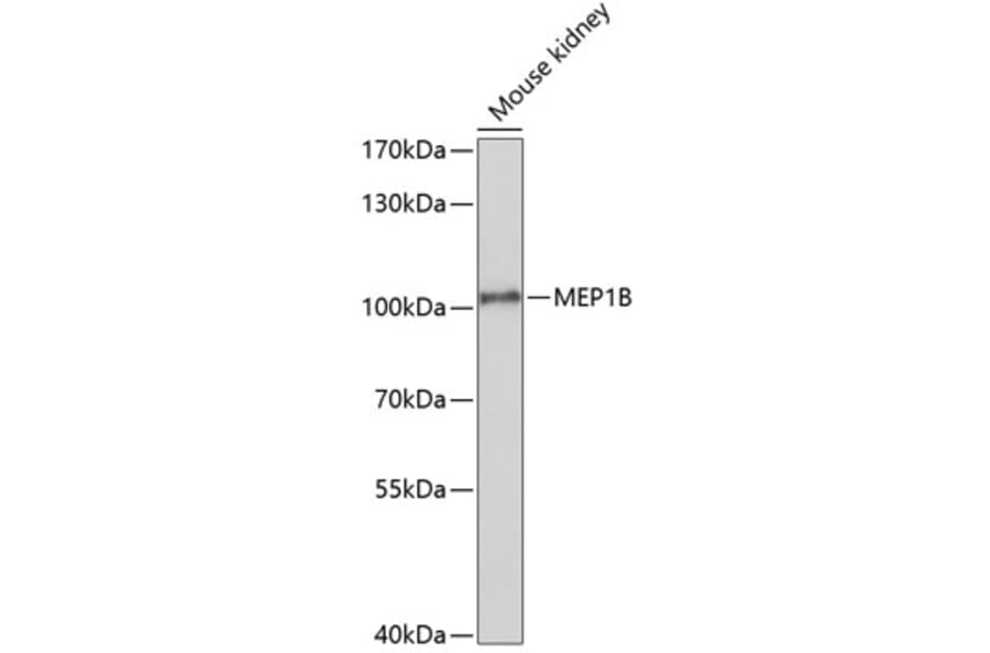 Western Blot - Anti-MEP1B Antibody (A10085) - Antibodies.com
