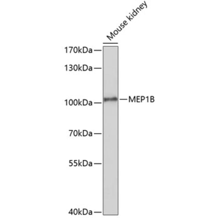 Western Blot - Anti-MEP1B Antibody (A10085) - Antibodies.com