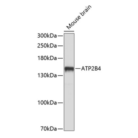 Western Blot - Anti-Calcium Pump PMCA4 ATPase Antibody (A16975) - Antibodies.com