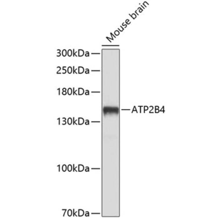 Western Blot - Anti-Calcium Pump PMCA4 ATPase Antibody (A16975) - Antibodies.com