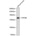 Western Blot - Anti-Calcium Pump PMCA4 ATPase Antibody (A16975) - Antibodies.com
